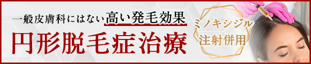 円形脱毛症治療