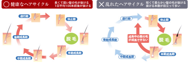 抜け毛にも違いがあります