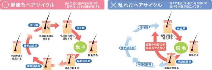 産後のヘアロス問題