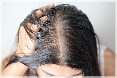 医師監修 女性の薄毛 頭頂部がハゲてしまう原因と対策 女性の薄毛研究室 Faga Lab 公式 Agaスキンクリニックレディース Aスキ