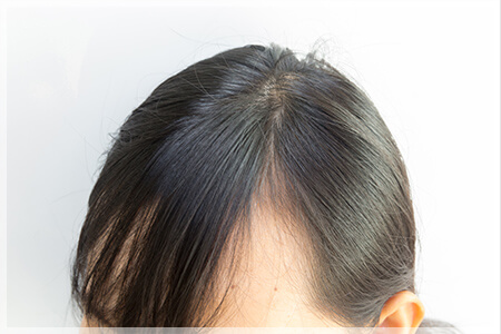 前髪が薄い女性向けの対策と目立たないヘアスタイル