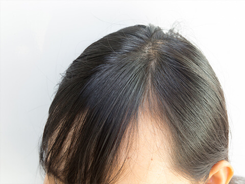 【医師監修】前髪が薄い女性向けの対策と目立たないヘアスタイル