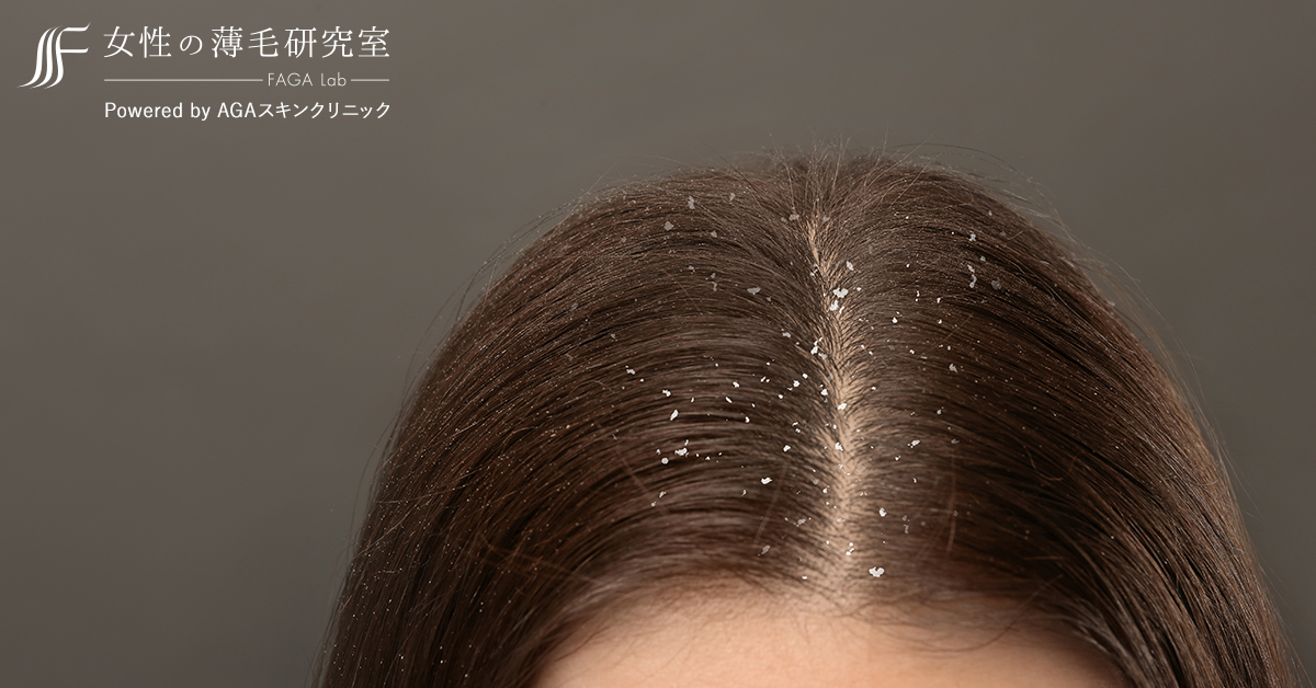 医師監修 頭皮のかゆみの原因とかゆみを抑える方法を紹介 公式 女性の薄毛治療専門病院 Agaスキンクリニック レディース院 Faga 医師監修 頭皮のかゆみの原因とかゆみを抑える方法を紹介 公式 女性の薄毛治療専門病院 Agaスキンクリニック レディース院 Faga