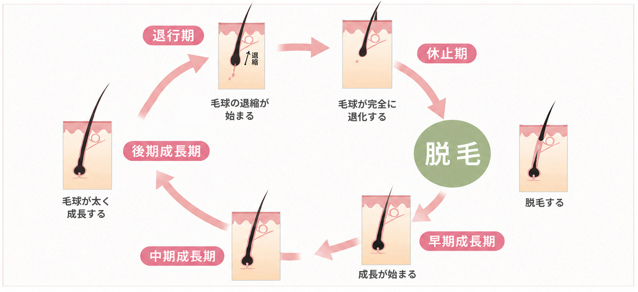 健康なヘアサイクルの場合は早期成長期、中期成長期、後期成長期、退行期、休止期を経て長くて固い髪の毛が抜けるサイクルを繰り返す