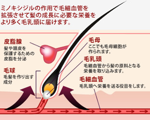 ミノキシジルイメージ