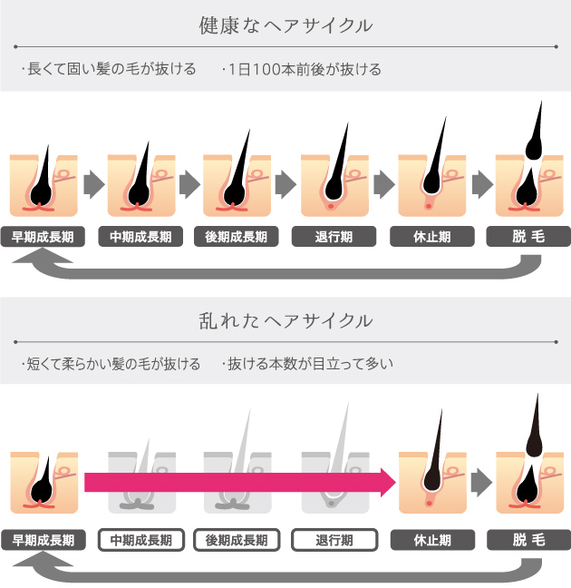 髪の健康診断 薄毛でお悩みの方はagaスキンクリニック レディース院へ