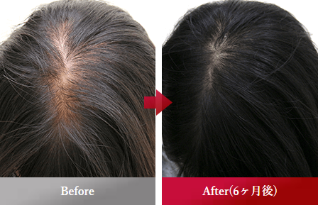 before_after