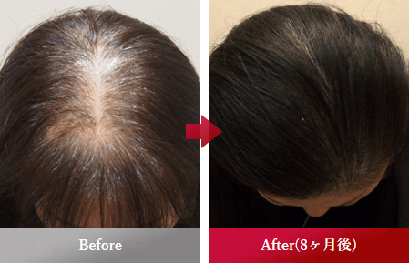 before_after