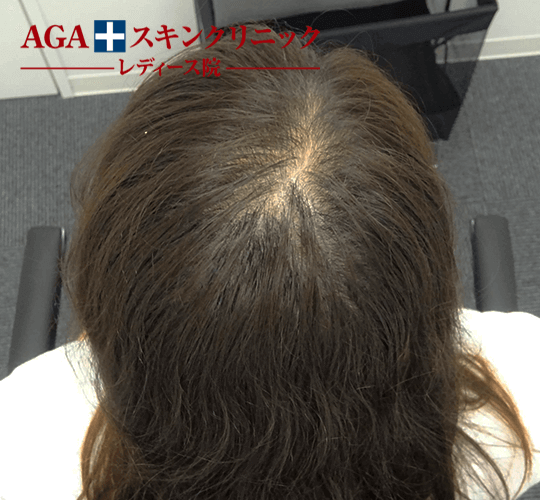 After(7ヶ月後)