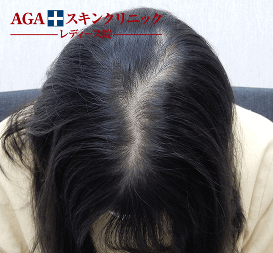 After(7ヶ月後)